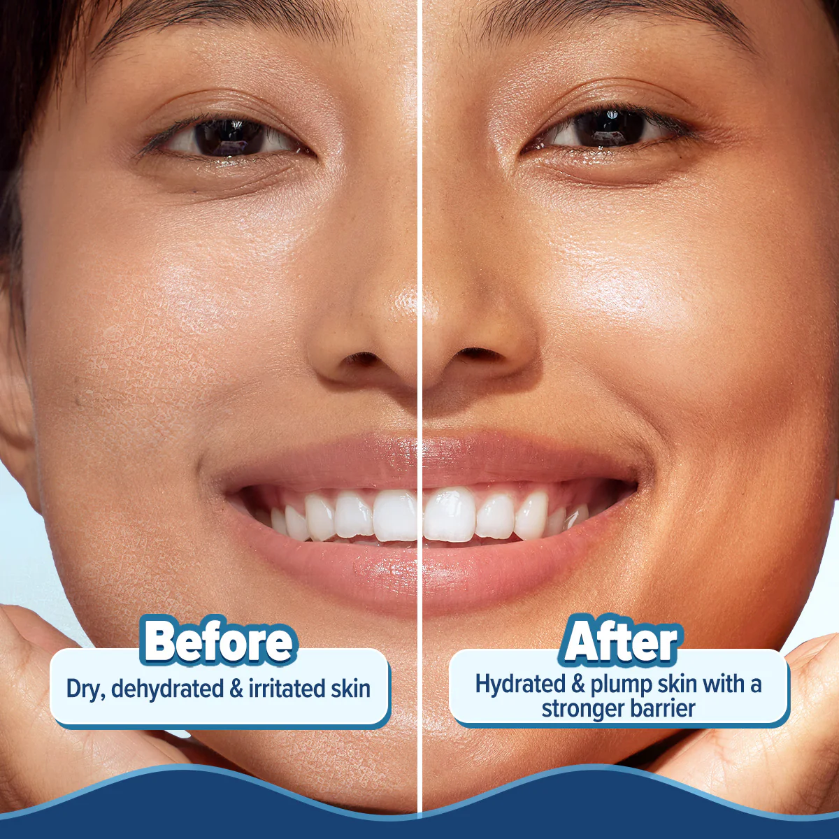 5 Barrier+ Hydra Gel Moisturizer with Avocado & 5 Essential Ceramides - 200 g - Image 7