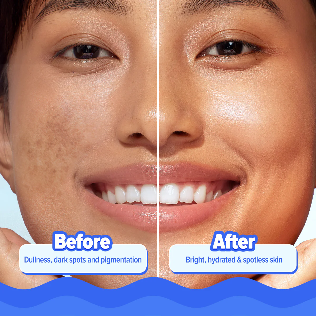Bright+ Hydra Gel Moisturizer with Blueberry & Kojic Acid - 200 g - Image 7