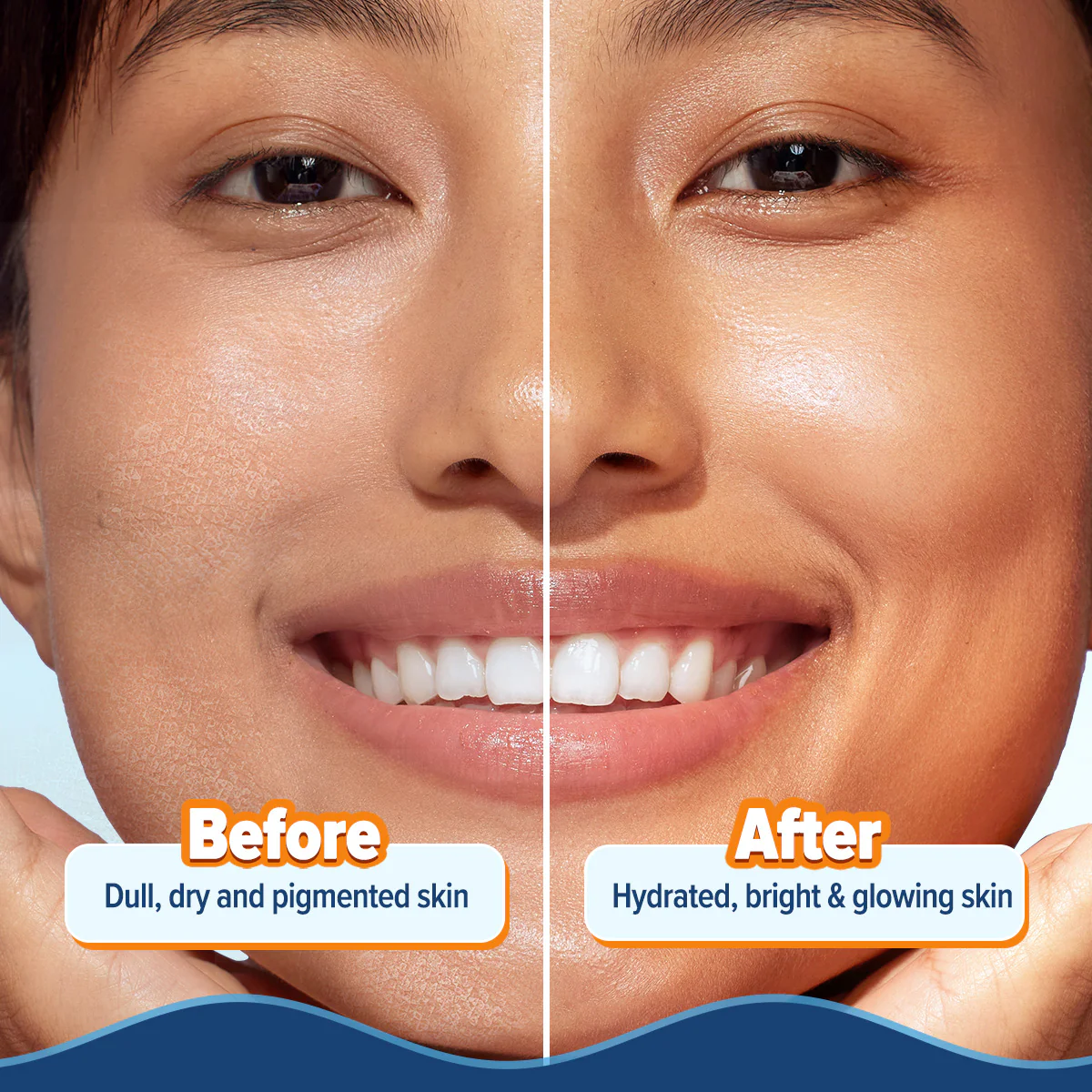 Glow+ Hydra Gel Moisturizer with Vitamin C & Papaya - 200 g (Pack of 2) - Image 6
