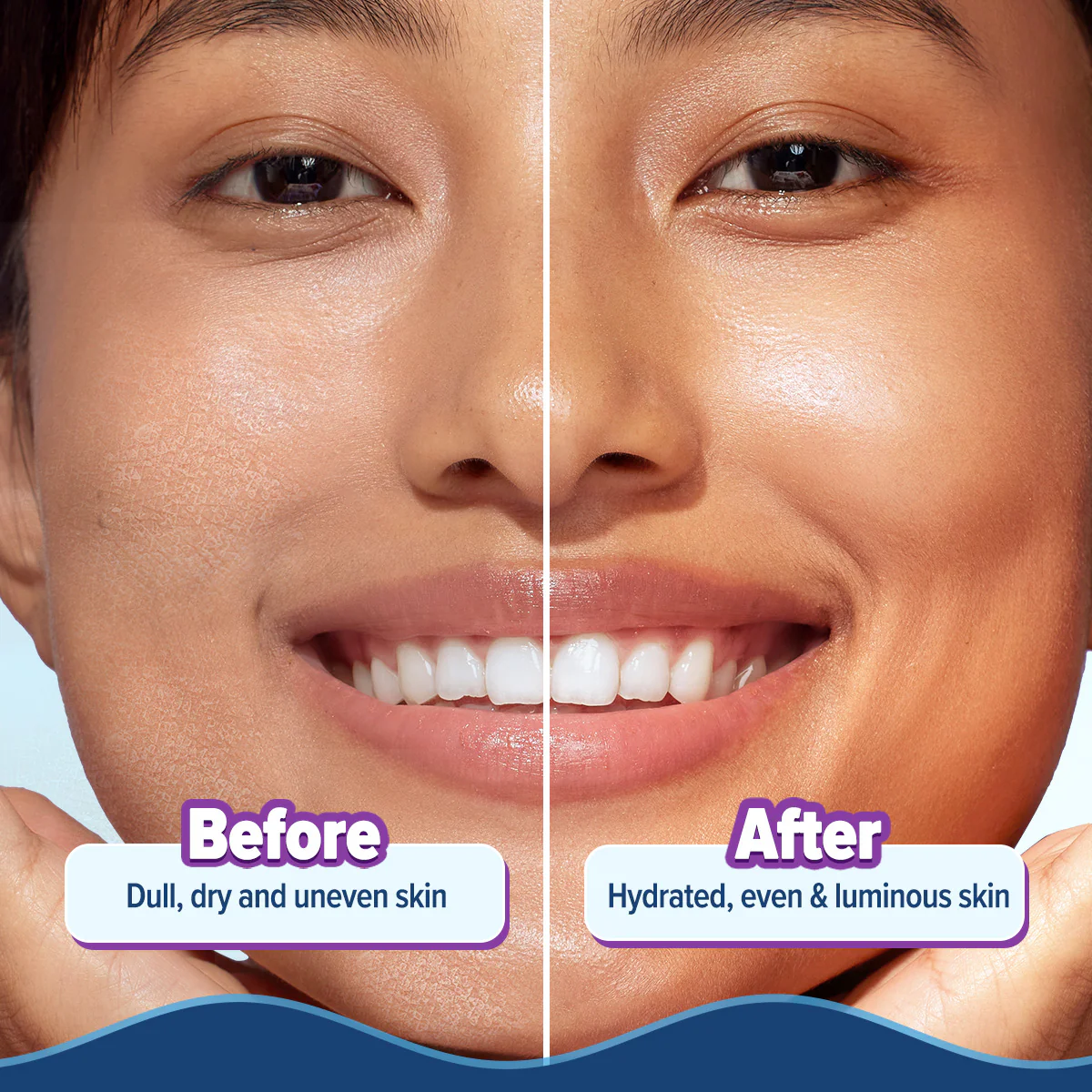 Illuminate + Hydra Gel Moisturizer with Wild Berries & Alpha Arbutin - 200g (Pack of 2) - Image 6